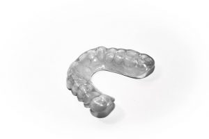 Eine Aufbissschiene hilft bei Zähneknirschen und lindert Zahnschmerzen